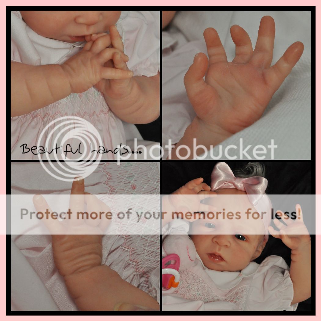 List 99+ Pictures Pictures Of Mottled Skin On Legs Full HD, 2k, 4k